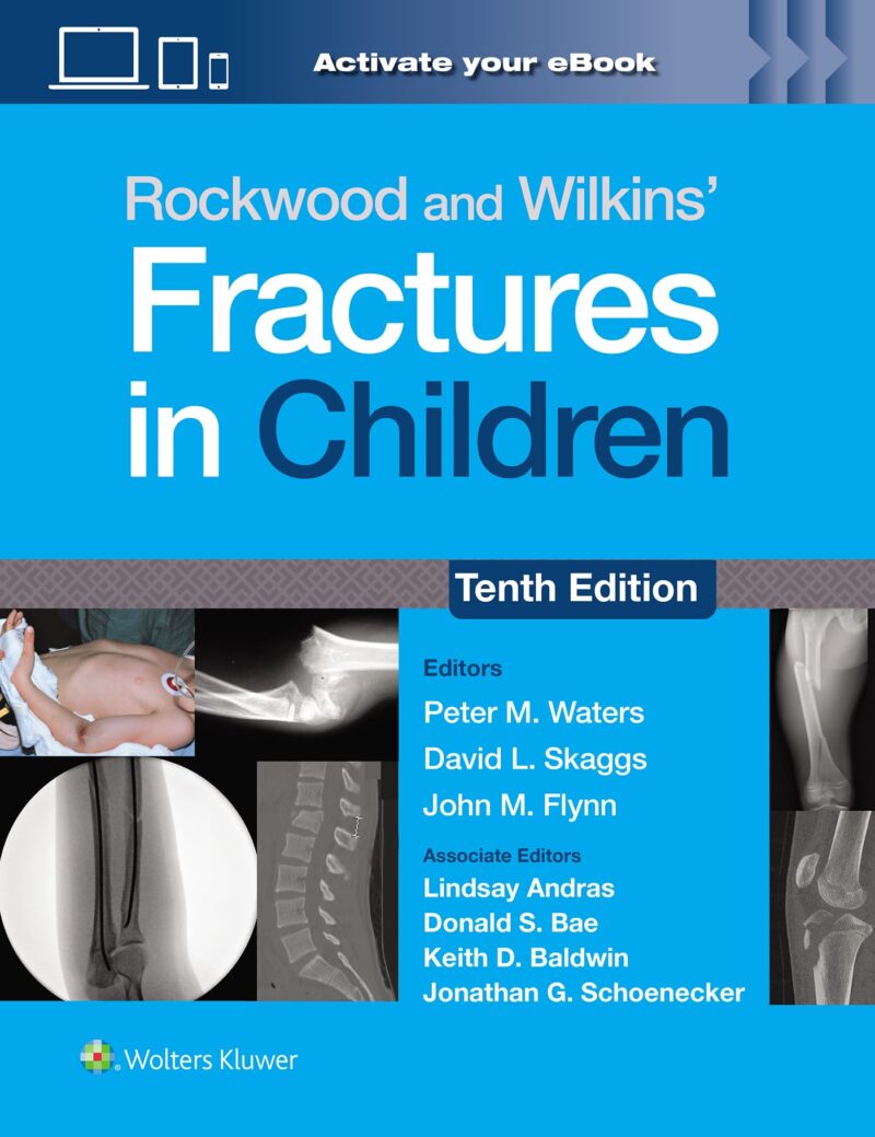 Rockwood and Wilkins' Fractures in Children