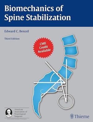 Biomechanics of Spine Stabilization