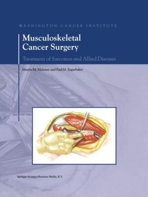 Musculoskeletal Cancer Surgery: Treatment of Sarcomas and Allied Diseases