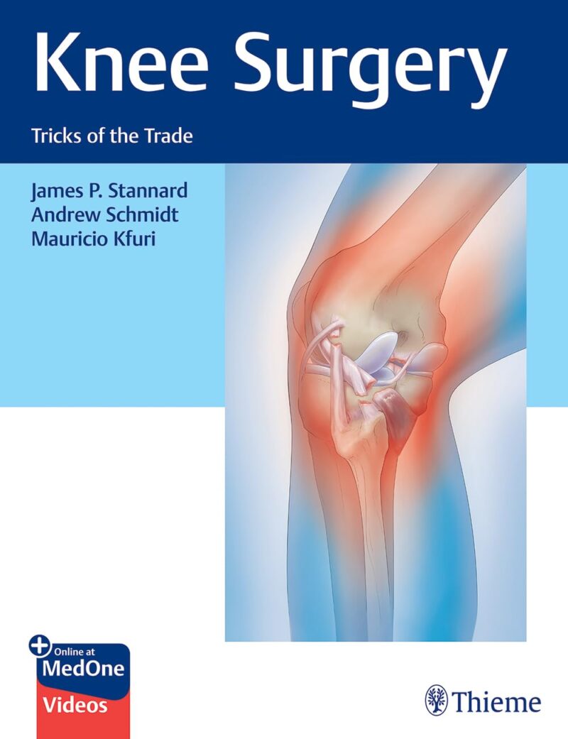 Knee Surgery: Tricks of the Trade With Videos