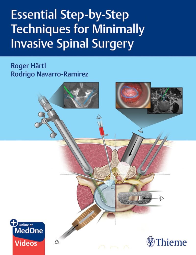 Essential Step-by-Step Techniques for Minimally Invasive Spinal Surgery With Videos