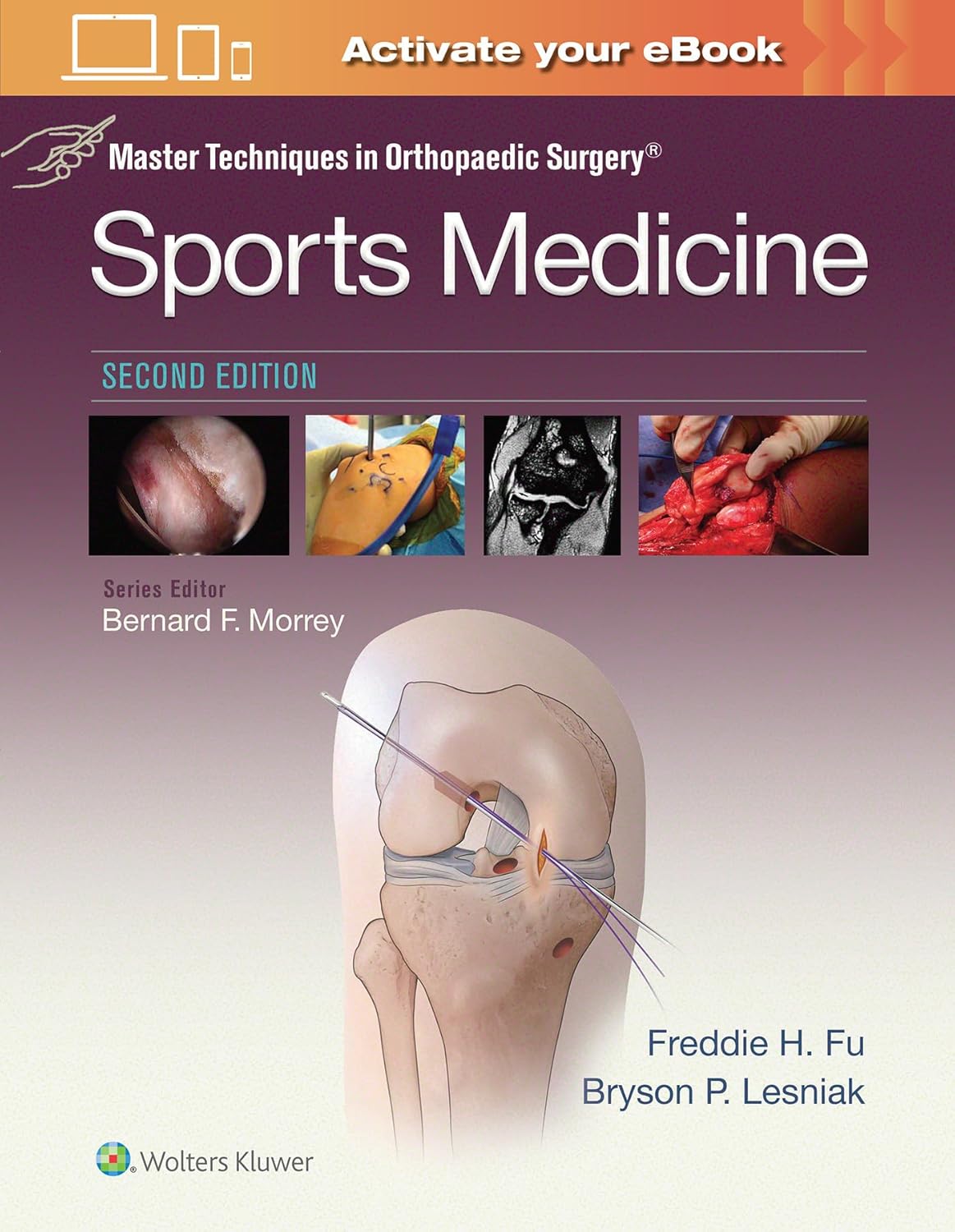 Master Techniques in Orthopaedic Surgery: Sports Medicin