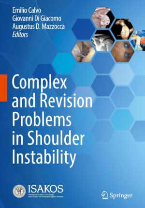 Complex and Revision Problems in Shoulder Instability