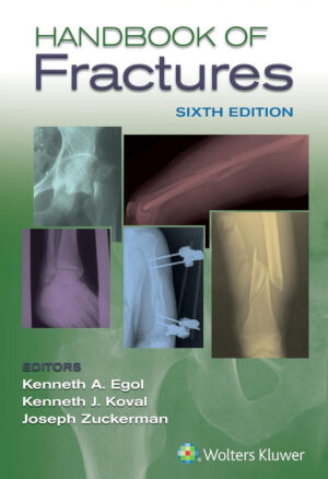 Handbook of Fractures