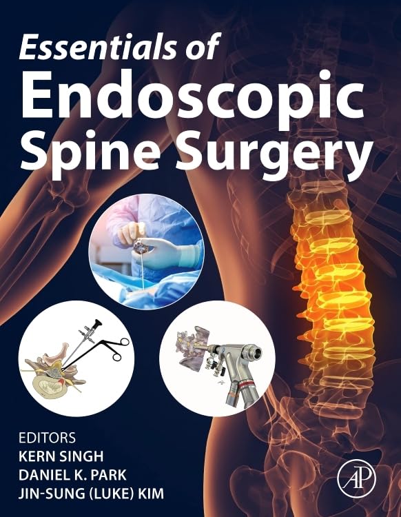 Essentials of Endoscopic Spine Surgery Without videos