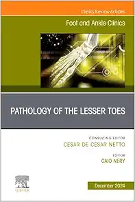 Pathology of the Lesser Toes, An issue of Foot and Ankle Clinics of North America (The Clinics: Orthopedics, Volume 29-4) (True PDF from Publisher)