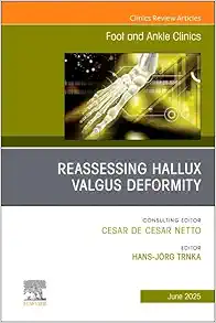 Reassessing Hallux Valgus Deformity, An Issue of Foot and Ankle Clinics of North America (Volume 30-2) (The Clinics: Orthopedics, Volume 30-2) (True PDF from Publisher)