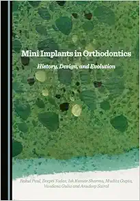 Mini Implants in Orthodontics: History, Design, and Evolution (Original PDF from Publisher)