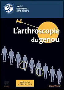 L’arthroscopie du genou (True PDF from Publisher)