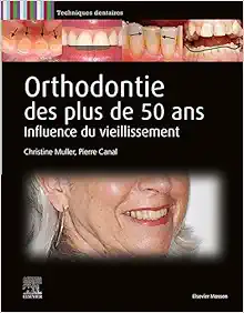 Orthodontie des plus de 50 ans: Influence du vieillissement (Original PDF from Publisher)