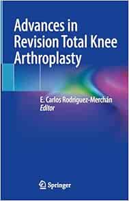 Advances in Revision Total Knee Arthroplasty (Original PDF from Publisher)