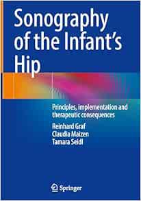 Sonography of the Infant’s Hip: Principles, implementation and therapeutic consequences (Original PDF from Publisher)