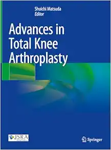 Advances in Total Knee Arthroplasty (Original PDF from Publisher)