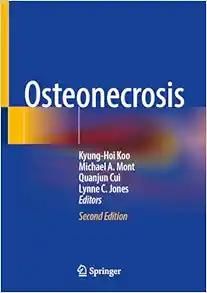 Osteonecrosis, 2nd Edition