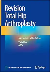 Revision Total Hip Arthroplasty: Approaches to THA Failure (Original PDF from Publisher)