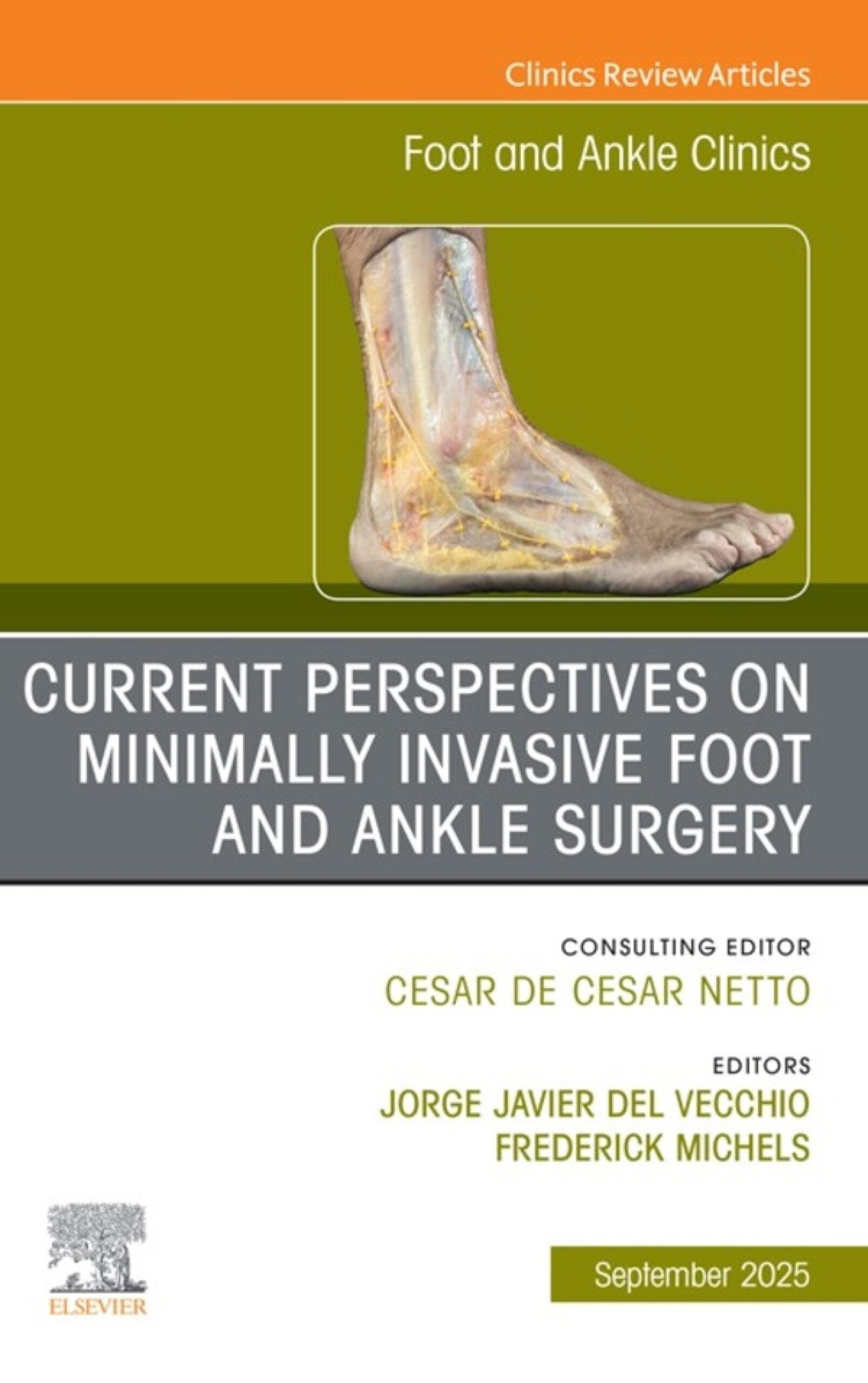 Current Perspectives on Minimally Invasive Foot and Ankle Surgery, An issue of Foot and Ankle Clinics of North America (Original PDF from Publisher)