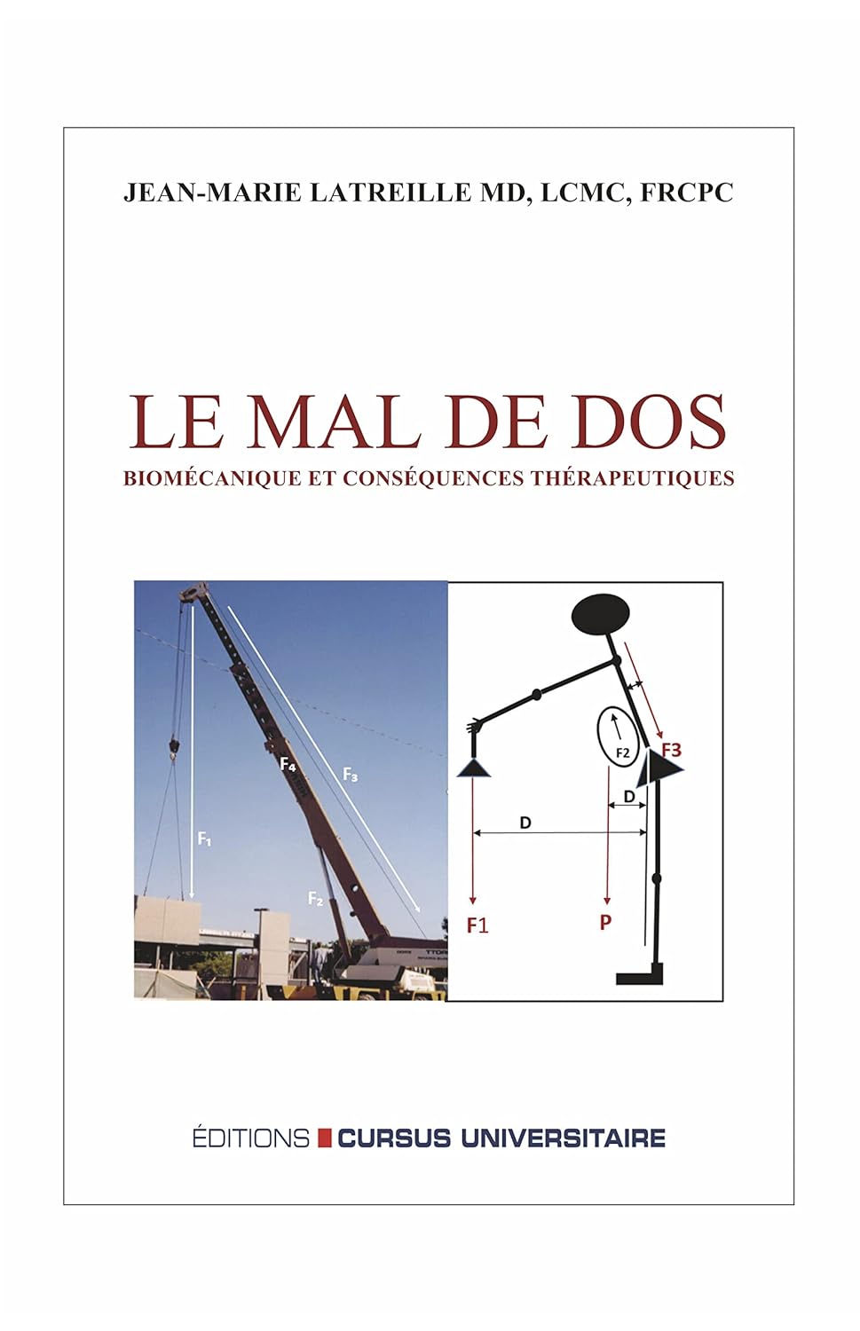 Le mal de dos: Biomécanique et conséquences thérapeutiques – 2ème édition revue et augmentée (French Edition) (Original PDF from Publisher)