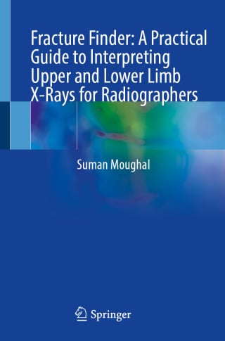Fracture Finder: A Practical Guide to Interpreting Upper and Lower Limb X-Rays for Radiographers (Original PDF from Publisher)