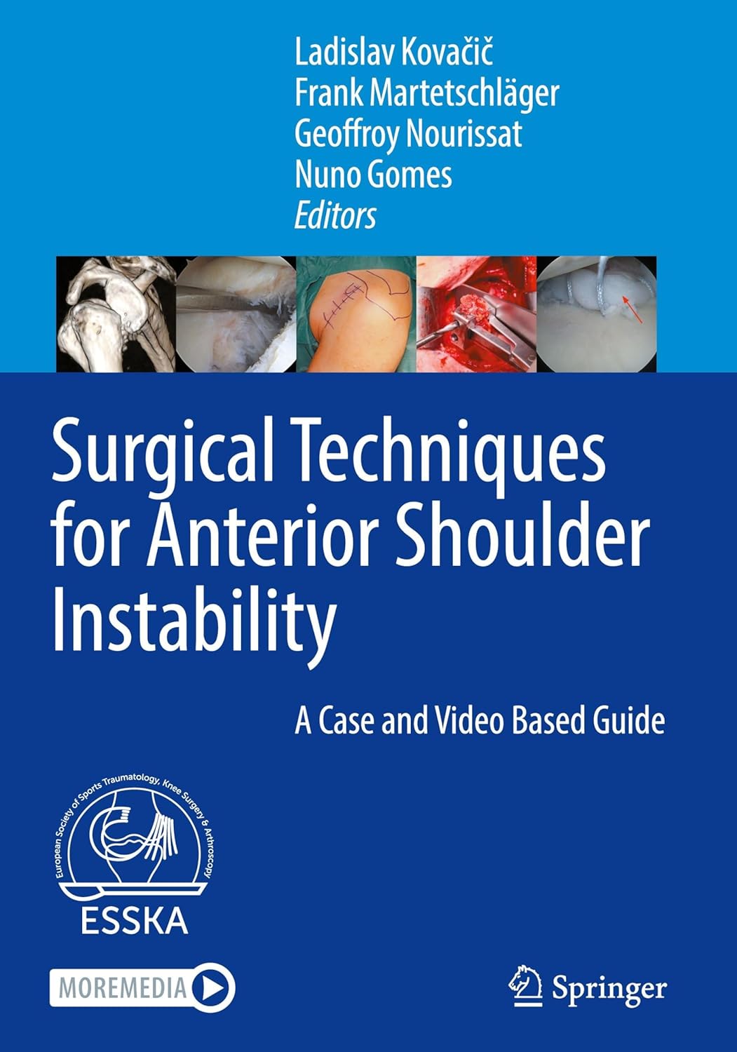 Surgical Techniques for Anterior Shoulder Instability: A Case and Video Based Guide (Original PDF from Publisher)
