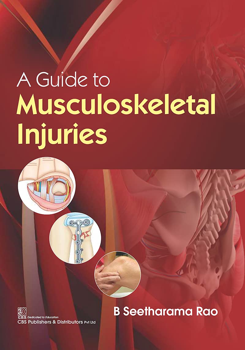 A Guide to Musculoskeletal Injuries (Original PDF from Publisher)