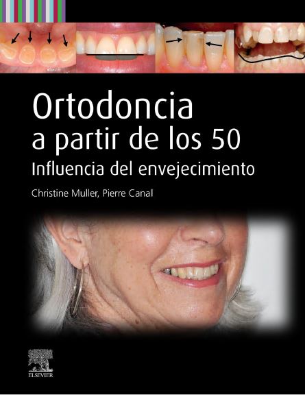 Ortodoncia a partir de los 50 (True PDF from Publisher)