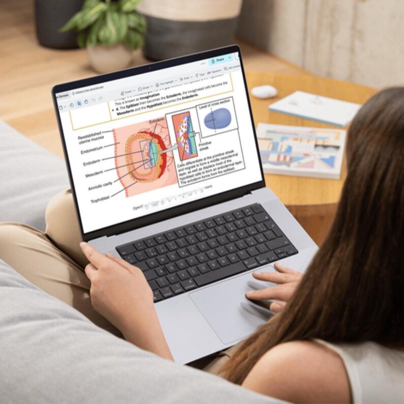 Musculoskeletal System Nursing Notes | Anatomy, Physiology and Pathology Study Guide | Bone & Joint Review | NCLEX PDF - Image 4
