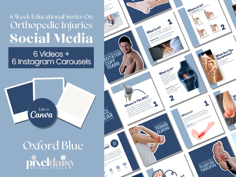 Orthopedic Injuries Instagram Video Templates for Therapists (Canva)