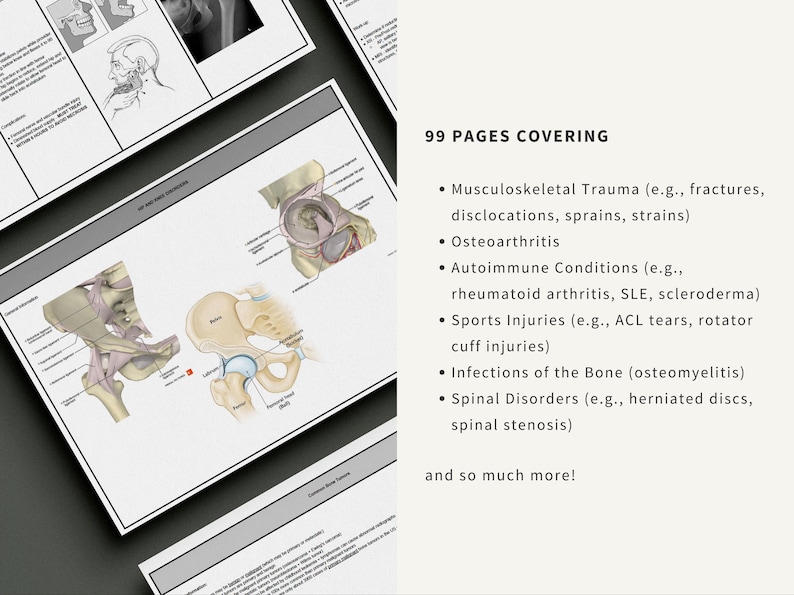 Orthopedics Master Note Study Guide, Physician Assistant, Nurse Practitioner, Medical Student, PANCE, PANRE - Image 3