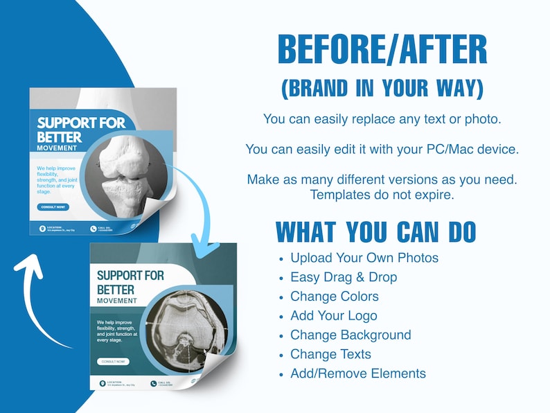 The Ultimate Orthopedic Clinic Social Media Kit | 100+ Fully Editable Canva Templates for Medical Professionals - Image 8